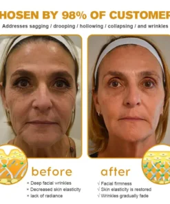 𝗧𝗟𝗢𝗣𝗔® Botox Bee Venom Wrinkle Removal Cream