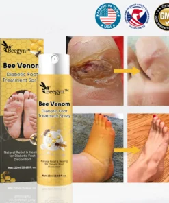 Beegyn™ Bee Venom Diabetic Foot Treatment Spray